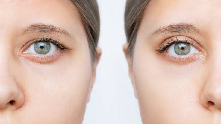 Hooded Eye Look