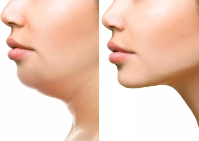 How To Get Rid Of Double Chin Fast At Home : 4 Tips That Work