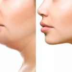How To Get Rid Of Double Chin Fast At Home