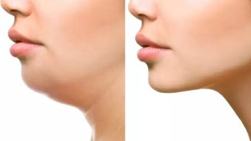 How To Get Rid Of Double Chin Fast At Home
