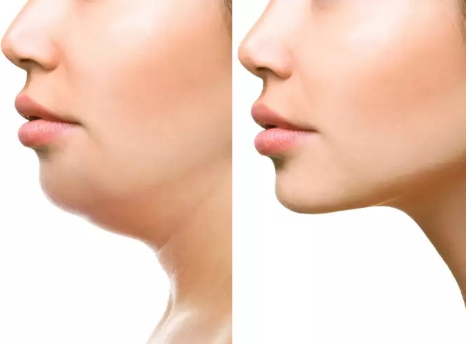 How To Get Rid Of Double Chin Fast At Home