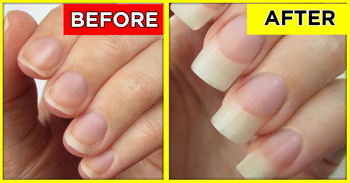 How To Get Stronger Nails Naturally